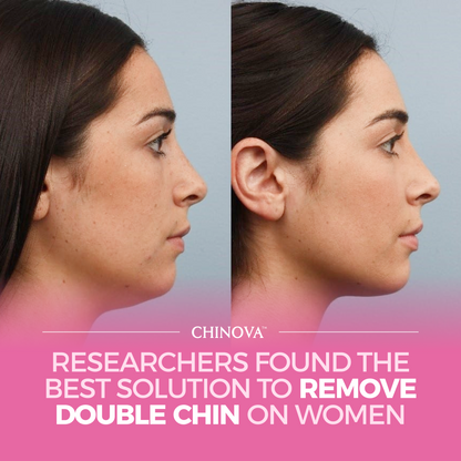 Chinova™ Mask — Reusable 5 Times Each