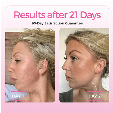 Chinova™ Mask — Reusable 5 Times Each